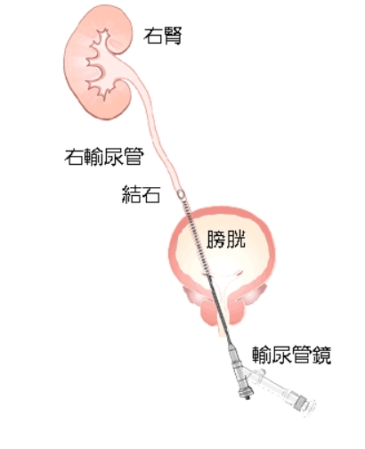擷取.PNG